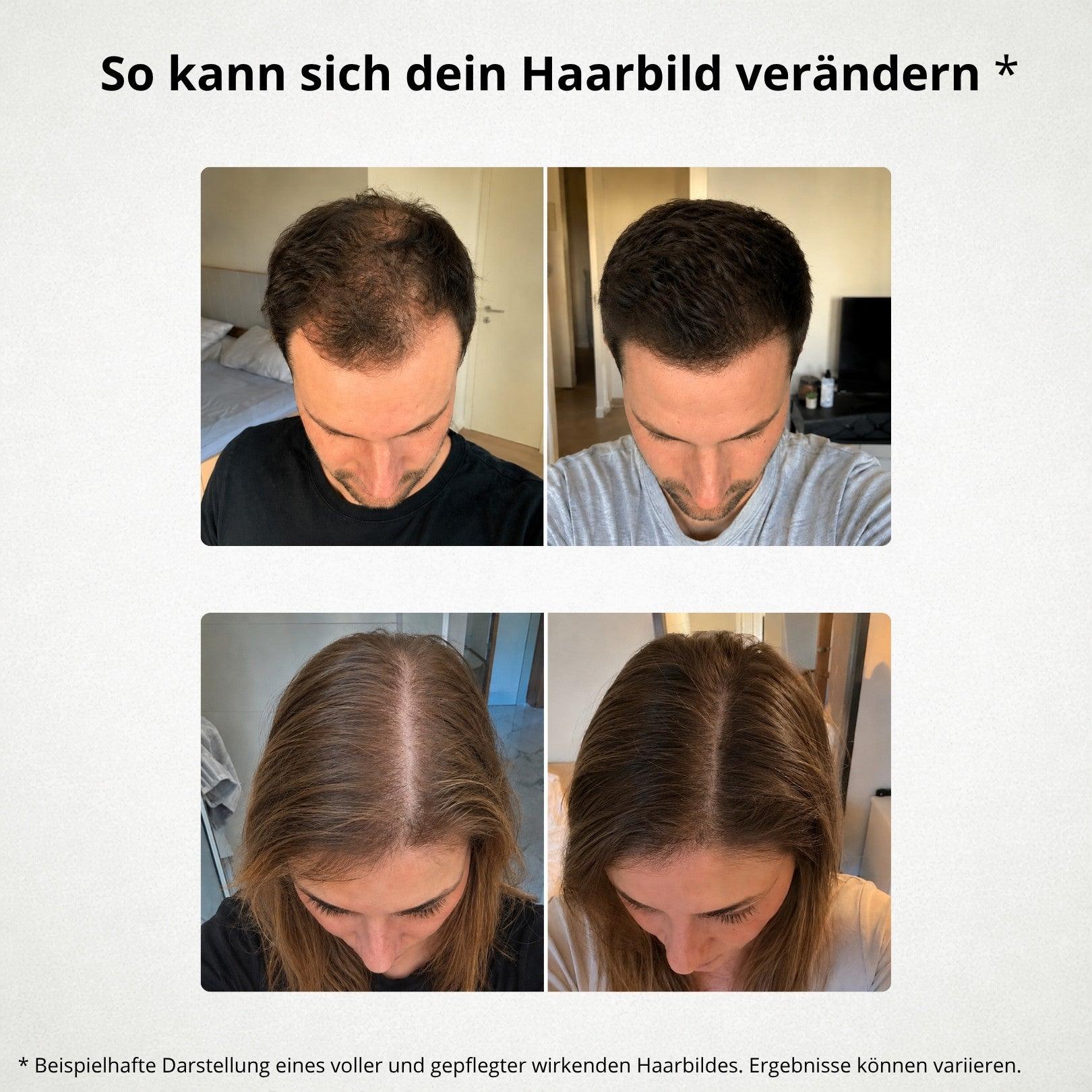 Mögliches Haarbild im dokumentierten Vergleich
