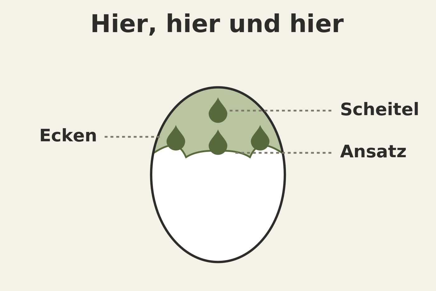 Grafik: die drei Stellen, an denen das Haar dünner wird, Geheimratsecken, Haarlinie, Scheitel, mit einem Tropfen auf jeder